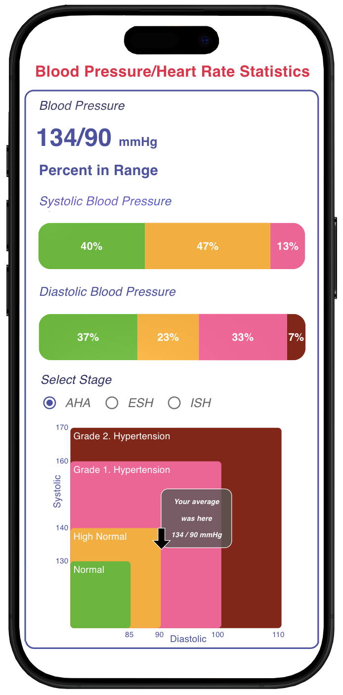 RAD cuffless blood pressure Holter device: 24-hour cardiovascular health monitoring with analytical reports on laptop and mobile.