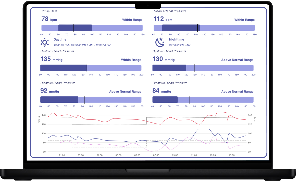 RAD cuffless blood pressure Holter device: 24-hour cardiovascular health monitoring with analytical reports on laptop and mobile.